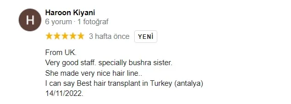 Hair Transplant Review 5