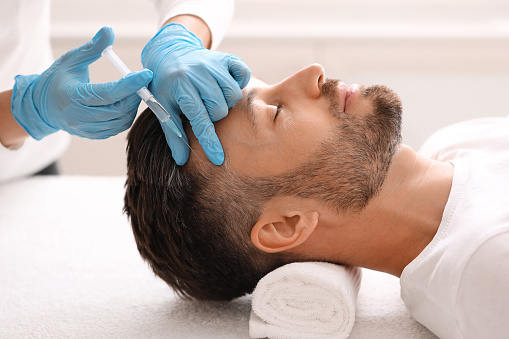 What İs Hair Mesotherapy For Man?
