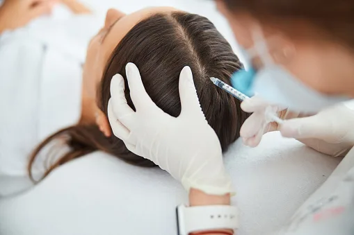 What İs Hair Mesotherapy For Women?